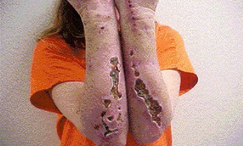 Tac-hai-cua-ma-tuy-da